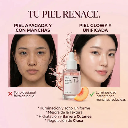 Anua Peach 70+ Niacinamide Serum 30ml